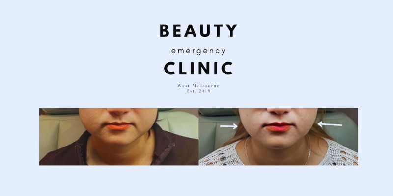 Beauty Emergency Clinic